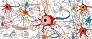 Over-wired brain