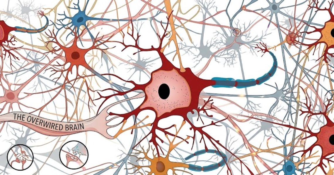 Over-wired brain